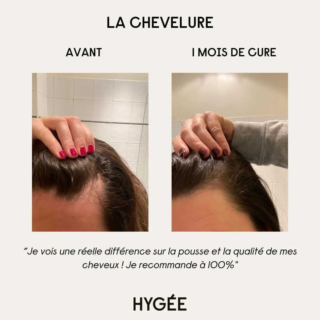 La Chevelure - Image 3